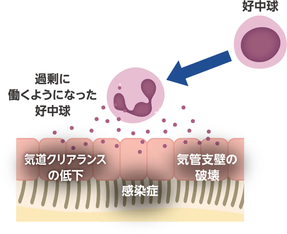 好中球が過剰に働き肺のダメージにつながるイメージ。気道クリアランスの低下、感染症、気道壁の破壊。